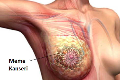 Dünya Kulüpler Kupası'nda şampiyon Manchester City