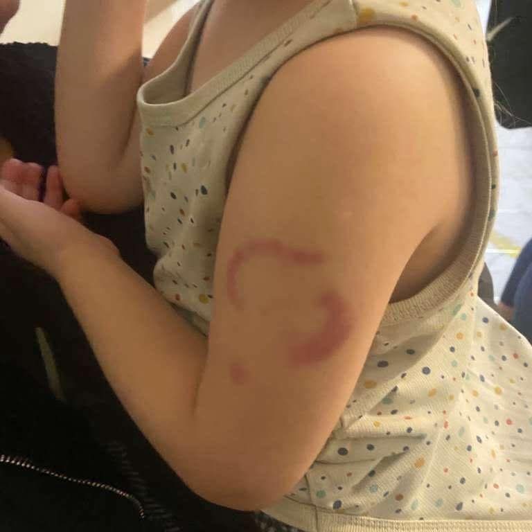 Edirne’de öğretmen hakkında “öğrencisini ısırdı” iddiası: “Isırmadım, öperken oldu”
